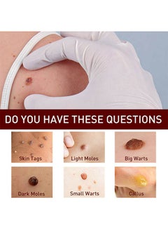 Body Wart Remove Flat ( pack off 2 )