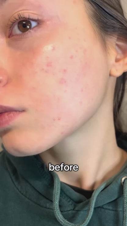 345 Relief Cream, 345 Intensive Repair Cream Barrier Cream, Face Moisturizer, Soothing, Hydration, Korean Skin Care for Dry & Sensitive Skin (1pc) MADE IN KOREA